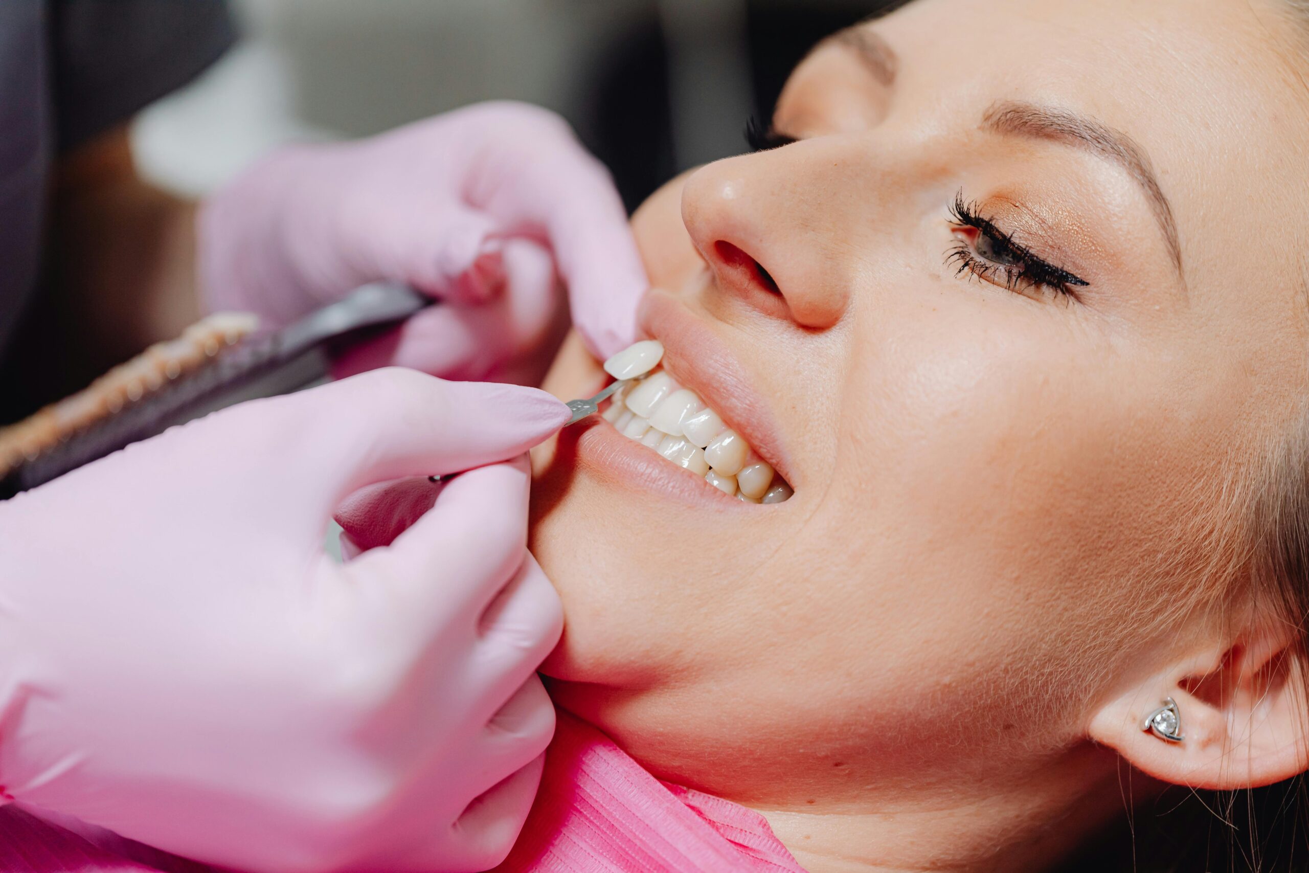 How Much Does a Root Canal Cost with Insurance